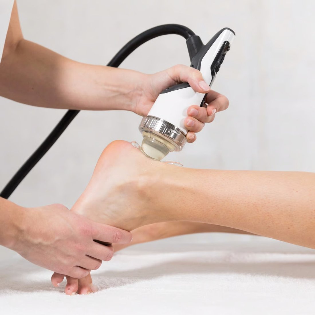 Stoßwellentherapie am Fuß