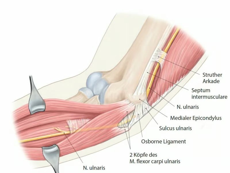 Anatomie: Nervenengpass am Ellbogen